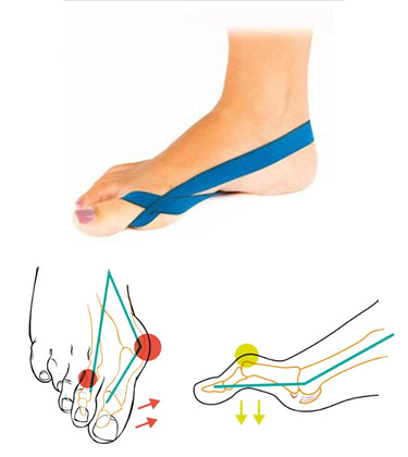 0023150 - 0023150-CORRETOR-JOANETE-DEDO-MARTELO-TAPE-LOOP-JUZO_3.JPG